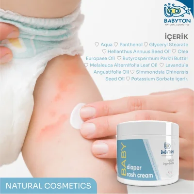 Babyton Pişik Önleyici Krem, 50 ml